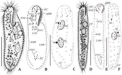 A New Record of Oxytricha granulifera granulifera Foissner and Adam, 1983 (Protozoa, Ciliophora, Oxytrichidae) From a Hot Spring in Iceland, With Notes on Its Abnormal Form During Cultivation